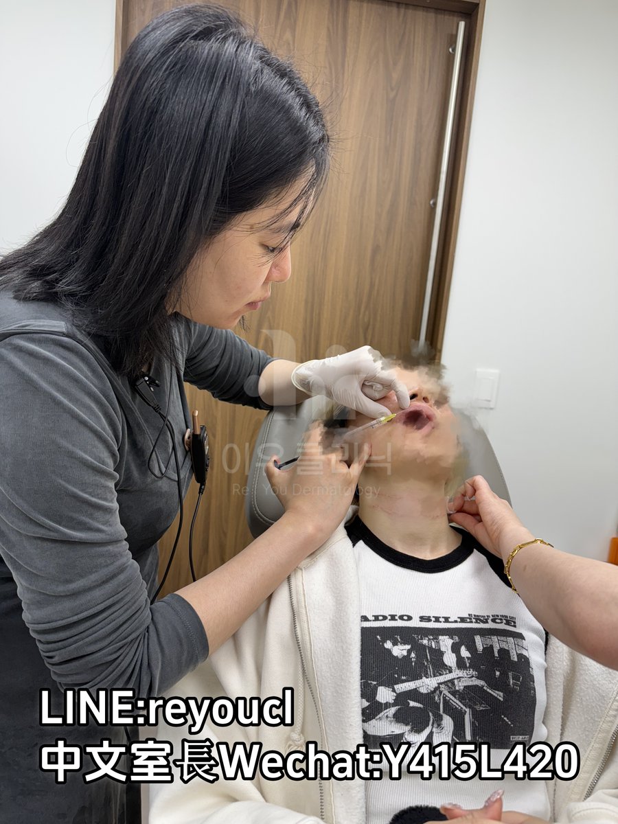 Moongaohan's tweet photo. 🔍 頸紋成因：被忽視的“第二張臉”老化信號頸部皮膚厚度僅為面部的1/3，且膠原蛋白流失速度更快

精準定位3大生理層
👉真皮層淺層：改善表皮細紋，恢復光滑觸感
👉 真皮深層：填充凹陷���壑，重建容積支撐
👉 筋膜層（選擇性）：通過“錨定點注射”提拉鬆弛組織頜💙line：reyoucl💙中文室長Wechat:Y415L420 https://t.co/puatUoY6jS