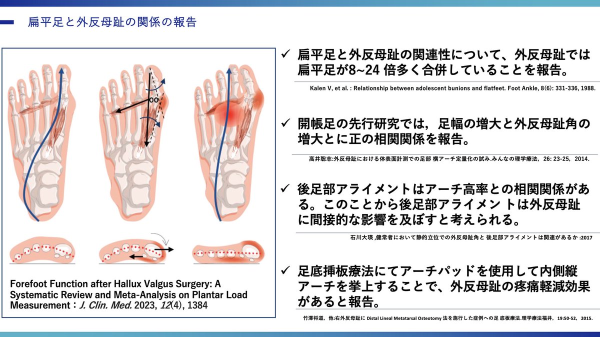 oshiroakito's tweet photo. 外反母趾の臨床症状🦶

「外反母趾＝母趾の痛み」だけでなく、
関連・起因する症状が足部内外にでます。

外反母趾ですねー...
変化してますねー...ではなく

訴えや痛みを詳細に聞き
背景や痛みの時系列、全身との関連性
まで考慮して紐解いていく必要があります🦶

#沖縄
#理学療法士
#外反母趾は沼 https://t.co/moCuCDUG2U