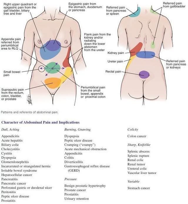Referred pain