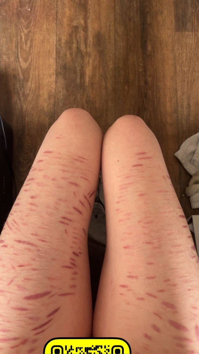 Am bloated cuz a girl gunna bleed but you can have me legs