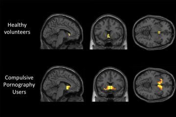 Ninja__Wisdom's tweet photo. I'm 23. 

I wasted 10 years of my life on P*rnhub every night. 

After 1078 days p**n free and 100+ hours studying its effects on our brain 

Here are my top 6 shocking discoveries that will change your life: https://t.co/lpBS4jOxYo