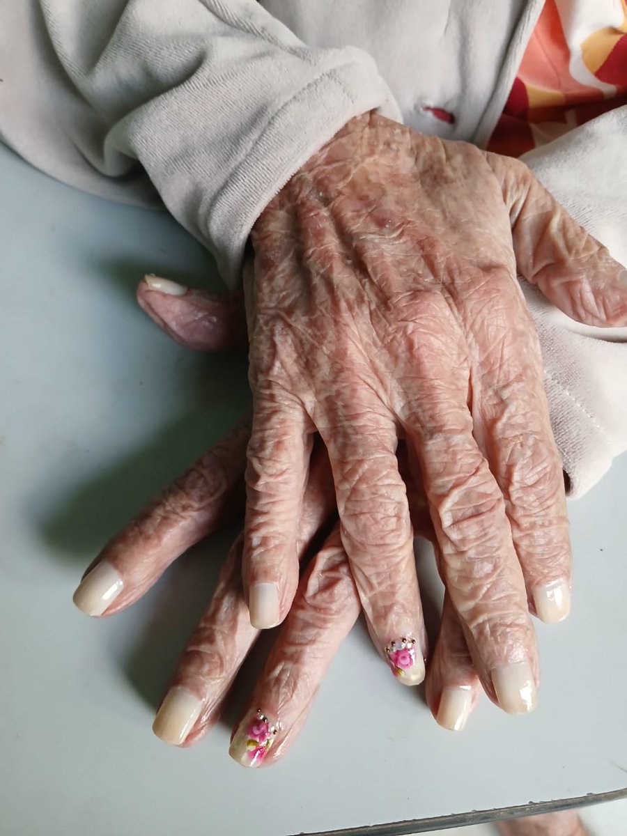 annacondaro's tweet photo. Voltando aqui pra dizer que minha bisa hoje faz 111 anos e tá de unhas feitas.
Ela gosta das florzinhas https://t.co/EQl57Yn7vM