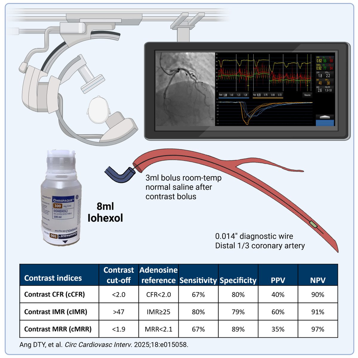 CircInterventions (@circintv) on Twitter photo Rapid exclusion of coronary microvascular dysfunction with novel contrast-derived indices of coronary microvascular function. A potential clinically useful, cost-saving method of testing <a href="/DamienCollison/">Damien Collison</a> <a href="/_RobSykes/">Robert Sykes</a> @conor1366 <a href="/DanielTYAng/">Daniel Ang</a> <a href="/ColinBerryMD/">Colin Berry</a> ahajrnls.org/4m46PPq Rapid exclusion of coronary microvascular dysfunction with novel contrast-derived indices of coronary microvascular function. A potential clinically useful, cost-saving method of testing <a href="/DamienCollison/">Damien Collison</a> <a href="/_RobSykes/">Robert Sykes</a> @conor1366 <a href="/DanielTYAng/">Daniel Ang</a> <a href="/ColinBerryMD/">Colin Berry</a> ahajrnls.org/4m46PPq