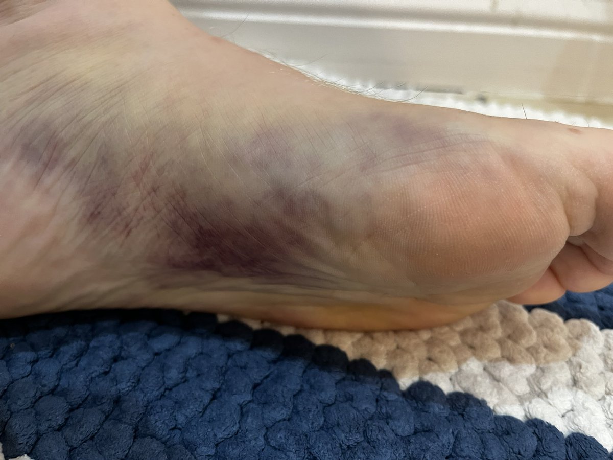 arober79's tweet image. 24/25 was wild