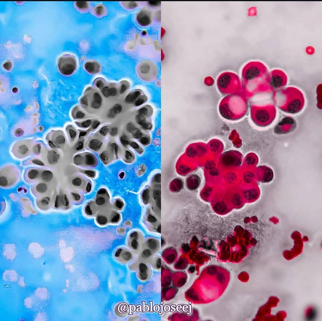 Aprilis / Aphrilis / Aperire / Abril / Afrodita / Abrir / Florecer / Primavera

#mythology #pathology #ethymology