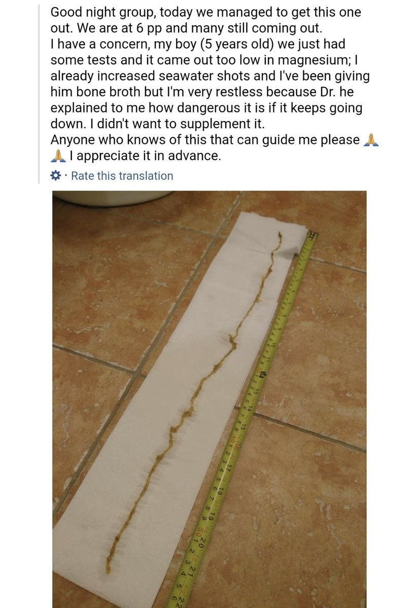 fionapettit71's tweet photo. 🧵Tomorrow @TrumpDoral will host abuser of #Autistic kids #AndreasKalcker 
He tells parents to poison their Autistic kids with #Chlorinedioxide BLEACH, give them burning bleach enemas.
Autistic kids shed intestinal tissue after being abused this way.
Upsetting images attached. https://t.co/fCUYHbjx8l