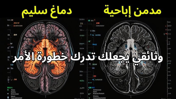 الإباحيةمن أخطر الكوارث التي صنعتها البشرية !

هي السم الذي يفتك بالعقول، ويخرب العلاقات، ويطفئ نور الرجولة في القلوب.

⬅️ إذا رأيت من يروج لها، فلا تتردد: احذفه، احظره، واهرب بدينك وكرامتك!
لأن الإباحية لا تُشاهد… بل تُدمِّر! وهذه بعض الأسباب:

لايك حبايبي وإليكم التفاصيل🤍