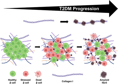 Extracellular Matrix News (@extracellmatrix) on Twitter photo This study out of <a href="/iitbombay/">IIT Bombay</a> illustrates how amylin incorporation in islet matrices through amylin–Col interactions drives #Type2Diabetes progression by impacting β-cell viability and insulin secretion. 🔬
🔗 bit.ly/4iDfF3t | <a href="/J_A_C_S/">J. Am. Chem. Soc.</a> This study out of <a href="/iitbombay/">IIT Bombay</a> illustrates how amylin incorporation in islet matrices through amylin–Col interactions drives #Type2Diabetes progression by impacting β-cell viability and insulin secretion. 🔬
🔗 bit.ly/4iDfF3t | <a href="/J_A_C_S/">J. Am. Chem. Soc.</a>