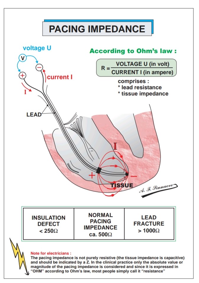 KostekMilan's tweet photo. Lead impedance ❗ 
Cardiac Pacemakers Step by Step -  An Illustrated Guide 
by S. Serge Barold, Roland X. Stroobandt, Alfons F. Sinnaeve https://t.co/z52q7zBjyr