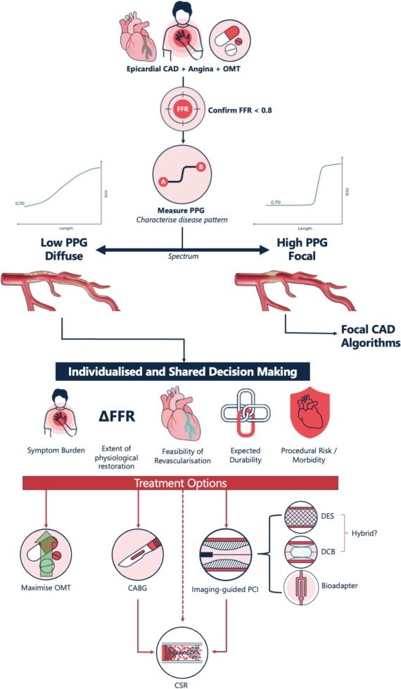 Carlos Collet MD PhD (@colletcarlos) on Twitter photo We are entering a new era in coronary revascularization—where predicting PCI success becomes central to clinical decision-making.
Our latest view on how this shift is reshaping the field
sciencedirect.com/science/articl…
<a href="/CardioAalst/">Hartcentrum Aalst</a> <a href="/PCRonline/">PCRonline 🫀</a> <a href="/TCTMD/">TCTMD</a> We are entering a new era in coronary revascularization—where predicting PCI success becomes central to clinical decision-making.
Our latest view on how this shift is reshaping the field
sciencedirect.com/science/articl…
<a href="/CardioAalst/">Hartcentrum Aalst</a> <a href="/PCRonline/">PCRonline 🫀</a> <a href="/TCTMD/">TCTMD</a>