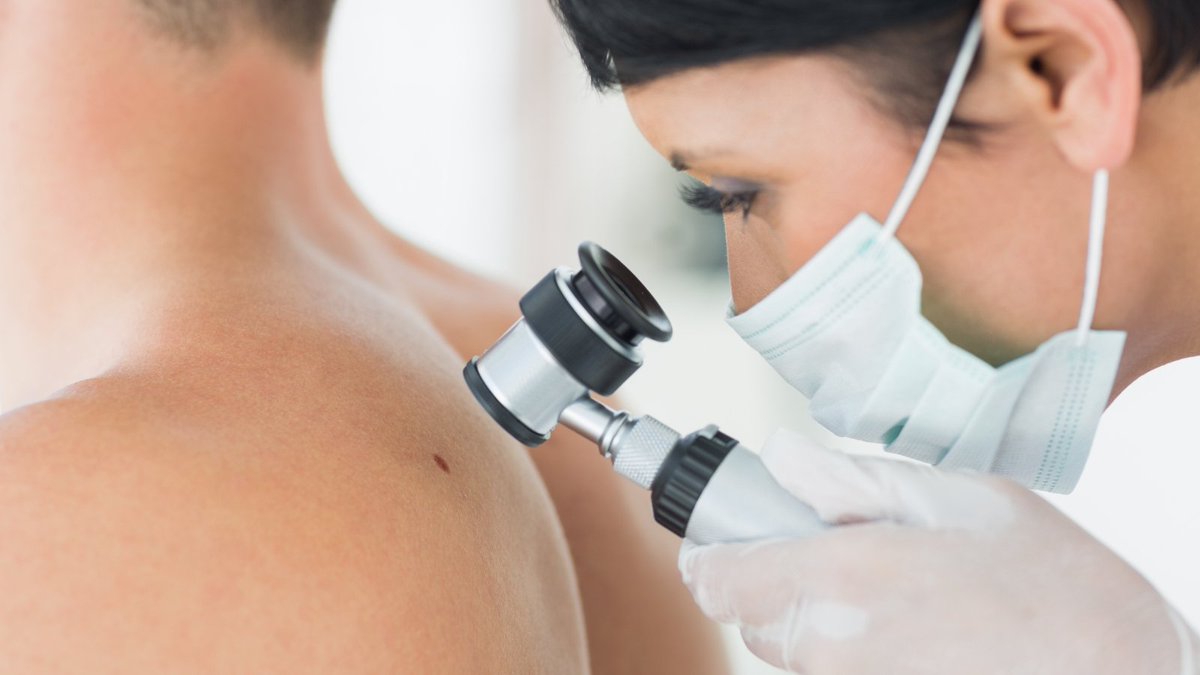 Nuffield Department of Medicine (@ndmoxford) on Twitter photo Today marks the start of #SkinCancerAwarenessMonth, and a new study with input from <a href="/HumanGeneticsOx/">Centre for Human Genetics</a> and <a href="/TGU_Oxford/">Translational Gastroenterology & Liver Unit (TGLU)</a> has discovered that a common but usually harmless virus could improve treatment outcomes in #melanoma patients 🦠🔬
Find out more 👉 ndm.ox.ac.uk/news/common-vi… Today marks the start of #SkinCancerAwarenessMonth, and a new study with input from <a href="/HumanGeneticsOx/">Centre for Human Genetics</a> and <a href="/TGU_Oxford/">Translational Gastroenterology & Liver Unit (TGLU)</a> has discovered that a common but usually harmless virus could improve treatment outcomes in #melanoma patients 🦠🔬
Find out more 👉 ndm.ox.ac.uk/news/common-vi…