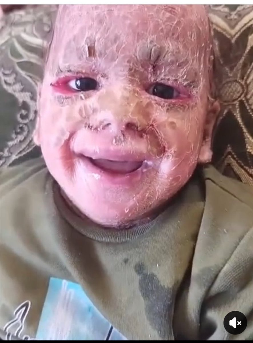 Yousef in Gaza 🇵🇸 tweet media