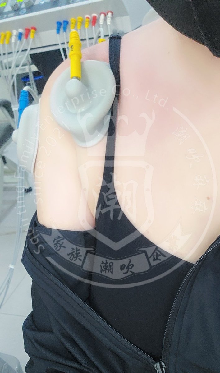 剛被復健師揉拎，爽痛爽痛
(很能認痛的我，其實痛到直接飆淚~~
我是什麼很M的人嗎？(誤！

醫生：才幾歲就五十肩還拖到沾黏
被復健師叮嚀，最近要每天報到😮‍💨 https://t.co/GAcbHZvraB