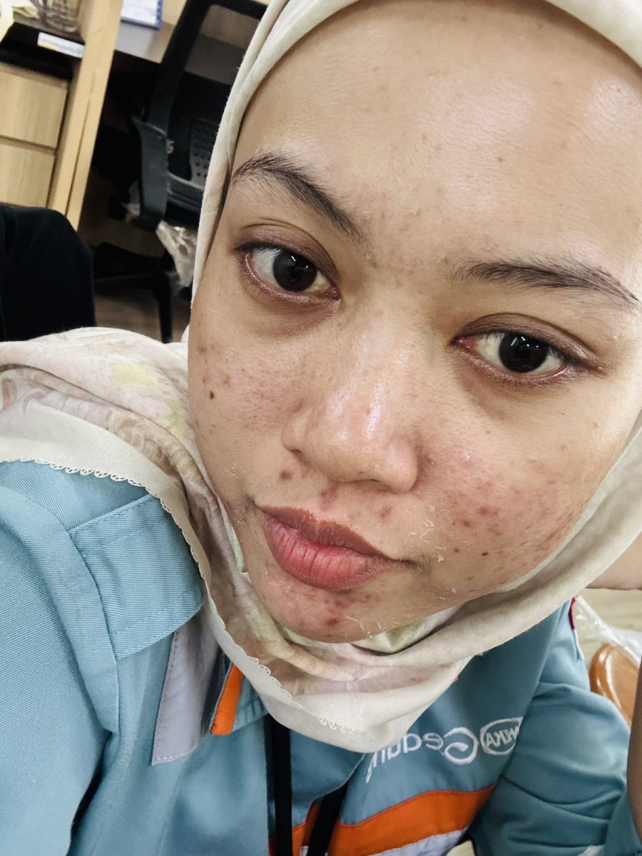 anggunvm's tweet photo. Akan kuhadapi breakout ini dengan tertawa dan berjuta juta🤝 https://t.co/DyZr8nZ1Bd