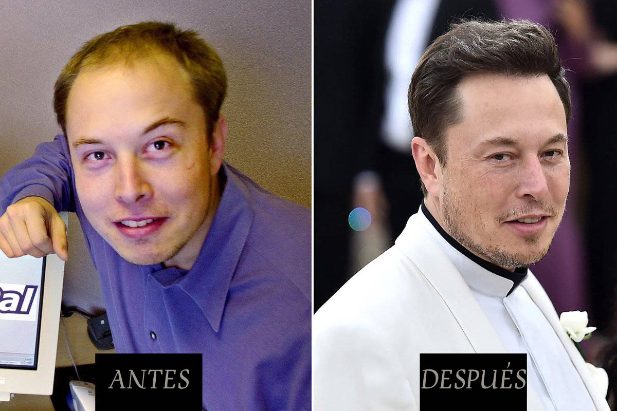 Este es Elon Musk.

CEO de Tesla y SpaceX, con un patrimonio de $247K Millones.

Pero detrás de su éxito brutal hay un principio que nadie te cuenta.

Aquí tienes 5 claves que explican su mentalidad (la #4 te va a volar la cabeza) 🧵