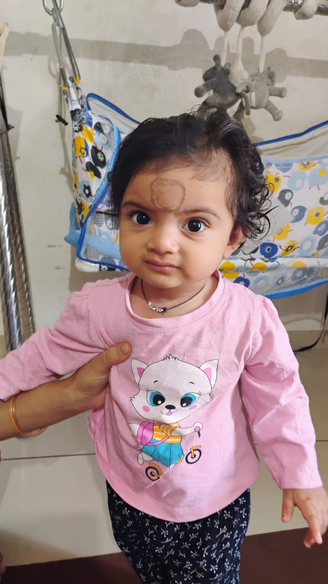 CollectorRjt's tweet image. રાષ્ટ્રીય બાળ સ્વાસ્થ્ય કાર્યક્રમ અંતર્ગત લોધિકા તાલુકાના કાંગશિયાળી ગામની બે વર્ષની શ્રી બારડની જન્મજાત  મૂકબધિરતાની ખામી કોકલેયર ઇનપ્લાન્ટ તેમજ સ્માઈલ થેરાપી વિના મૂલ્યે  કરી મળ્યું નવું જીવન.