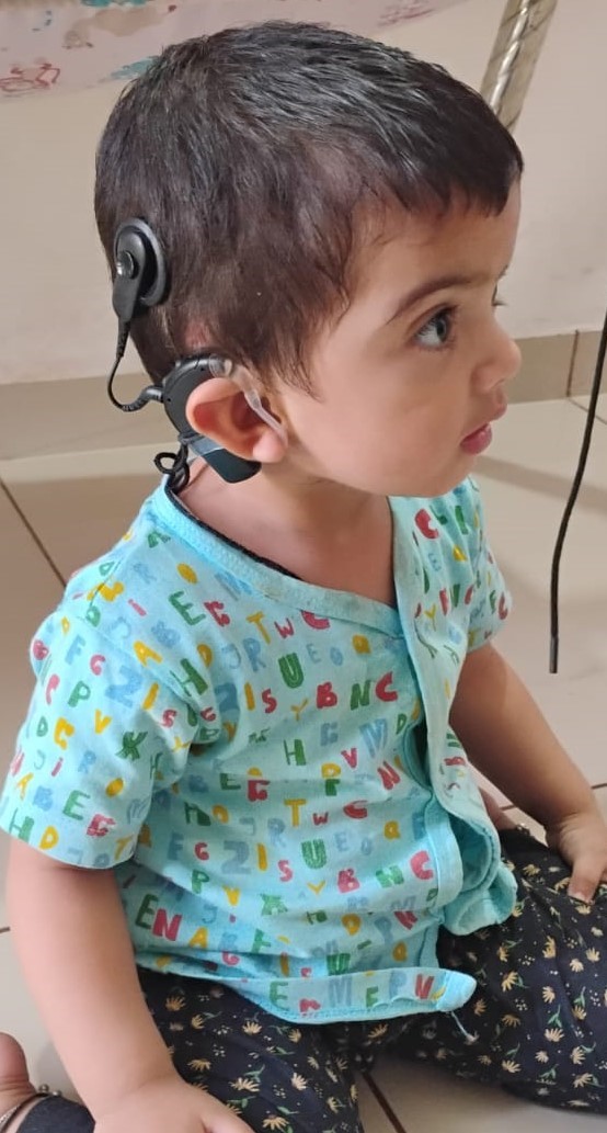 CollectorRjt's tweet image. રાષ્ટ્રીય બાળ સ્વાસ્થ્ય કાર્યક્રમ અંતર્ગત લોધિકા તાલુકાના કાંગશિયાળી ગામની બે વર્ષની શ્રી બારડની જન્મજાત  મૂકબધિરતાની ખામી કોકલેયર ઇનપ્લાન્ટ તેમજ સ્માઈલ થેરાપી વિના મૂલ્યે  કરી મળ્યું નવું જીવન.