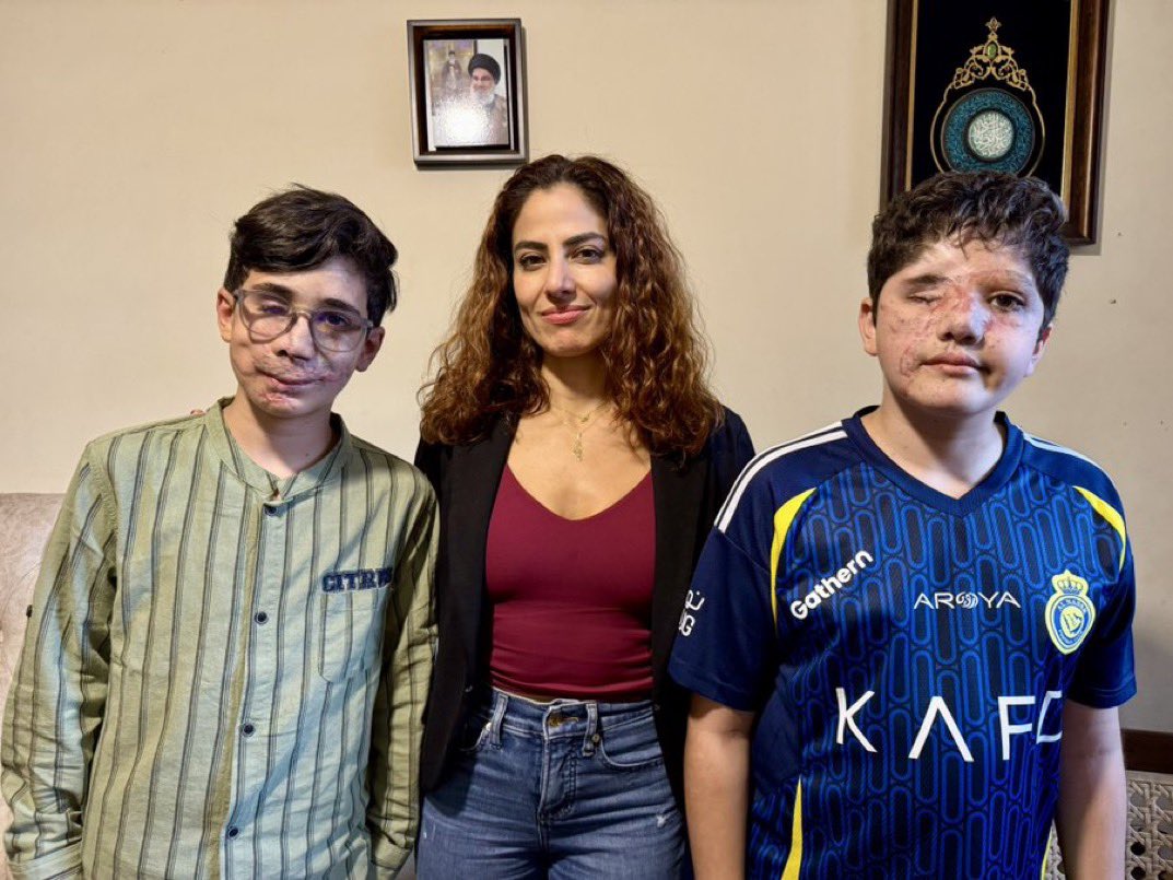 Leyla Hamed (@leylahamed) on Twitter photo These two boys, Ali and Hussein, are victims of the ‘stunning’ pager attack. <a href="/RaniaKhalek/">Rania Khalek</a> interviewed them both recently.
Arden Ostrovsky calls himself a human rights lawyer while glorifying the terrorism that did this to them. Monster is an understatement. These two boys, Ali and Hussein, are victims of the ‘stunning’ pager attack. <a href="/RaniaKhalek/">Rania Khalek</a> interviewed them both recently.
Arden Ostrovsky calls himself a human rights lawyer while glorifying the terrorism that did this to them. Monster is an understatement.