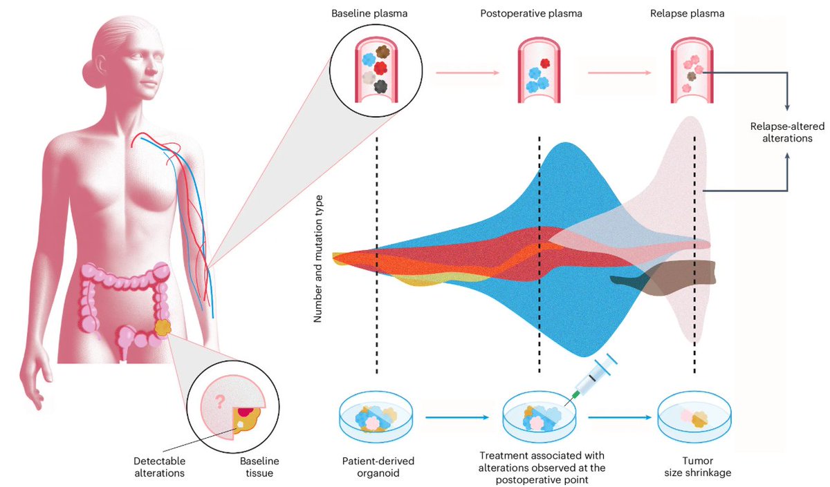 Intestinal Cell News (@intestinal_cell) on Twitter photo 🧬 Dr. Jorge Martín-Arana (<a href="/KokeMartin/">Jorge Martin Arana</a>) and team at <a href="/incliva_iis/">INCLIVA</a> performed whole-exome sequencing of ctDNA at different time points in participants with relapsed colon cancer in two independent cohorts.
🔓 <a href="/NatureCancer/">Nature Cancer</a> | go.nature.com/4iH5ueq 🧬 Dr. Jorge Martín-Arana (<a href="/KokeMartin/">Jorge Martin Arana</a>) and team at <a href="/incliva_iis/">INCLIVA</a> performed whole-exome sequencing of ctDNA at different time points in participants with relapsed colon cancer in two independent cohorts.
🔓 <a href="/NatureCancer/">Nature Cancer</a> | go.nature.com/4iH5ueq