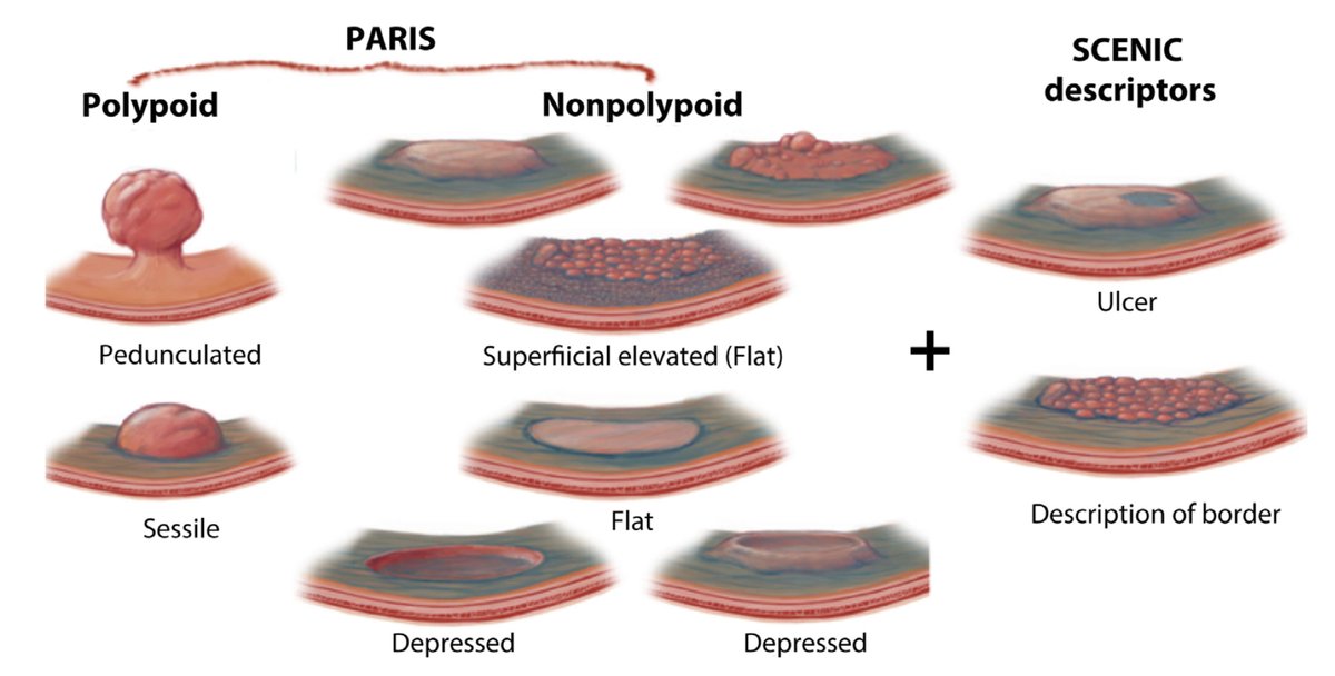 Keith Siau tweet media