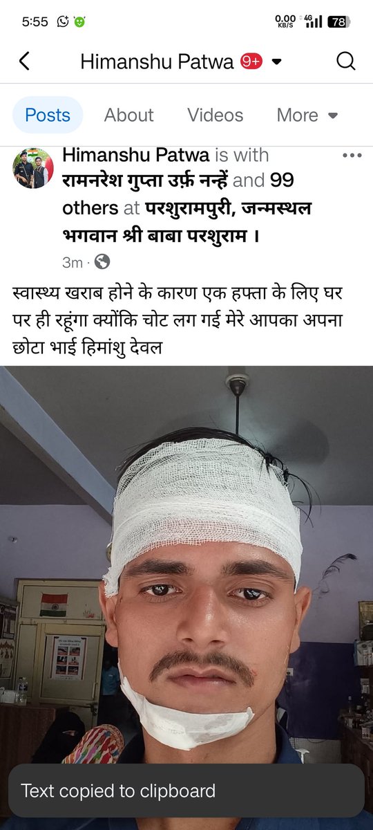 Deval7Deval's tweet image. स्वास्थ्य खराब होने के कारण एक हफ्ता के लिए घर पर ही रहूंगा क्योंकि मोटर साइकिल से चोट लग गई मेरे आपका अपना छोटा भाई हिमांशु देवल