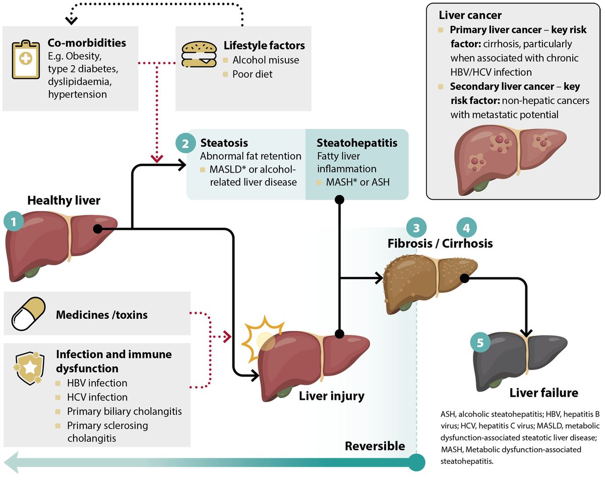 drsthanus's tweet photo. Physiological spectrum of progressive liver disease.

https://t.co/qGsrGwYPQn https://t.co/h4QcLoXifZ