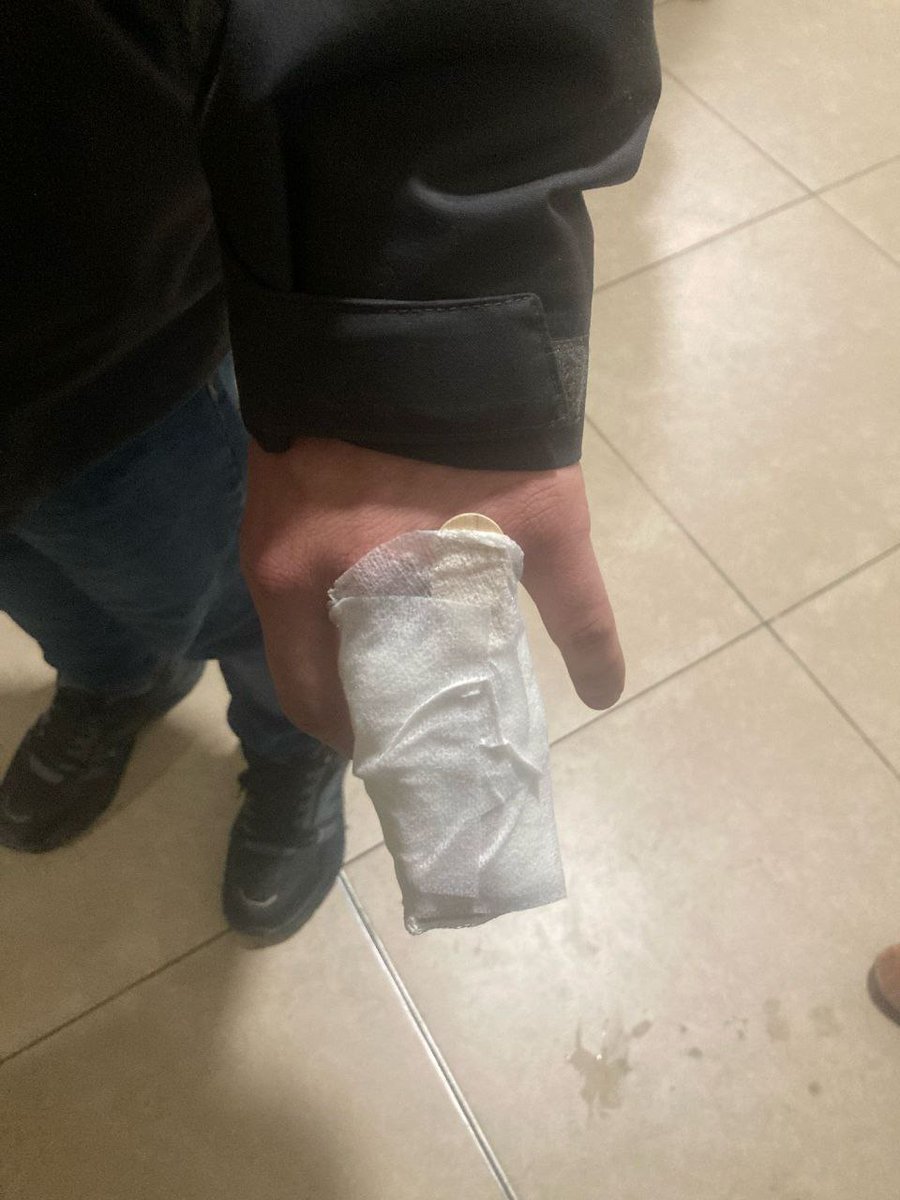 Mecidiyeköy'de darp edilerek gözaltına alınan Yapı Yol-İş Sendikası'ndan Barış Kaya'nın parmakları çatlatıldı.