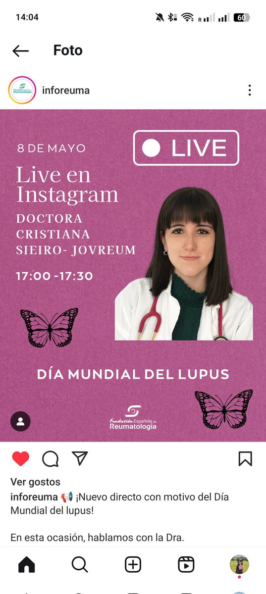 Cristiana Sieiro Santos (@cristianasieiro) on Twitter photo Este 8 de mayo a las 17h, directo en Instagram con <a href="/SEReumatologia/">Soc.Esp.Reumatología</a> por el #DíaMundialDelLupus 🦋
Hablamos sobre qué es el lupus, su impacto en la vida diaria, la importancia del diagnóstico precoz y del enfoque multidisciplinar 🙌
<a href="/LupusEurope/">Lupus Europe</a> <a href="/Felupus/">Federación Española Lupus | #LUPUSESPAÑA</a> <a href="/LupusMadrid/">Asociación de #Lupus de Madrid</a> <a href="/JOVREUM/">JOVREUM</a> Este 8 de mayo a las 17h, directo en Instagram con <a href="/SEReumatologia/">Soc.Esp.Reumatología</a> por el #DíaMundialDelLupus 🦋
Hablamos sobre qué es el lupus, su impacto en la vida diaria, la importancia del diagnóstico precoz y del enfoque multidisciplinar 🙌
<a href="/LupusEurope/">Lupus Europe</a> <a href="/Felupus/">Federación Española Lupus | #LUPUSESPAÑA</a> <a href="/LupusMadrid/">Asociación de #Lupus de Madrid</a> <a href="/JOVREUM/">JOVREUM</a>