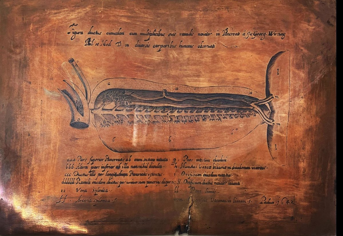 Giovanni Marchegiani (@gio_marchegiani) on Twitter photo ✨ Although his primacy was subsequently challenged by a student, it is now known that Johann Georg Wirsüng 🇩🇪 the prosector of <a href="/UniPadova/">Università di Padova</a> 🇮🇹 discovered the human pancreatic duct in 1642 during the dissection of an executed murderer…
(Where can you see this?!) 👇 🙋 ✨ Although his primacy was subsequently challenged by a student, it is now known that Johann Georg Wirsüng 🇩🇪 the prosector of <a href="/UniPadova/">Università di Padova</a> 🇮🇹 discovered the human pancreatic duct in 1642 during the dissection of an executed murderer…
(Where can you see this?!) 👇 🙋