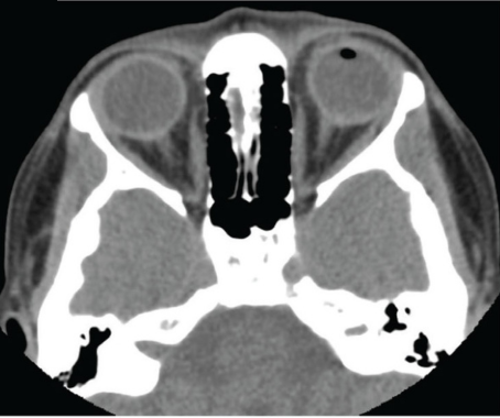 Retina Specialist tweet media