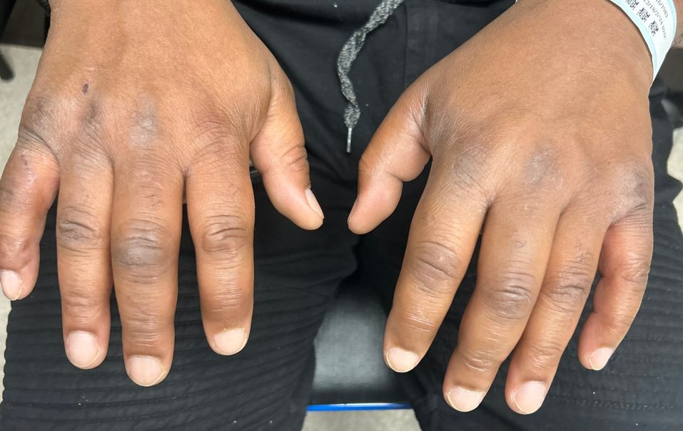 EM Case Challenge: Joint Pains
erpocketbooks.com/em-cases-mri/p…