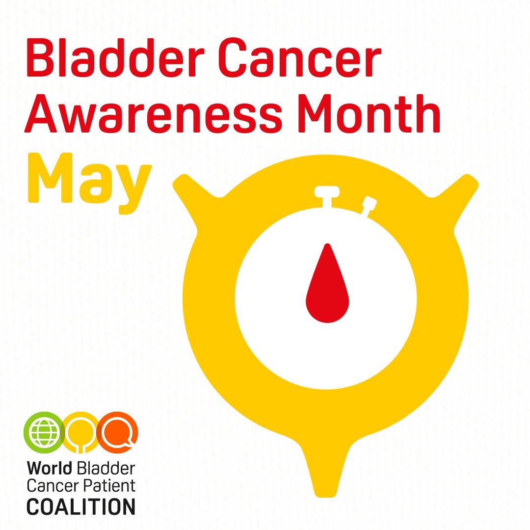 Yüksel Ürün (@dryukselurun) on Twitter photo May is Bladder Cancer Awareness Month 🎗️
🩸Blood in urine is never normal.
⏰Early detection saves bladders—and lives.
Let’s raise awareness, fight stigma, and support research.
#BladderCancer #CancerAwareness #Oncology
<a href="/WorldBladderCan/">World Bladder Cancer Patient Coalition</a> <a href="/OncoAlert/">OncoAlert</a> <a href="/AmerUrological/">Amer. Urol. Assn.</a> <a href="/Uroweb/">European Association of Urology (EAU)</a> #AUA25 May is Bladder Cancer Awareness Month 🎗️
🩸Blood in urine is never normal.
⏰Early detection saves bladders—and lives.
Let’s raise awareness, fight stigma, and support research.
#BladderCancer #CancerAwareness #Oncology
<a href="/WorldBladderCan/">World Bladder Cancer Patient Coalition</a> <a href="/OncoAlert/">OncoAlert</a> <a href="/AmerUrological/">Amer. Urol. Assn.</a> <a href="/Uroweb/">European Association of Urology (EAU)</a> #AUA25