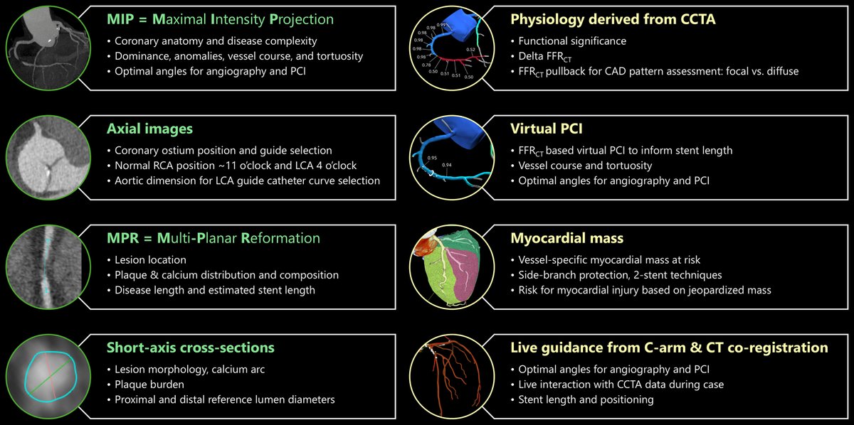 MyJSCAI's tweet image. 🆕Presented at #SCAI2025 - @SCAI / @Heart_SCCT roundtable highlighting use of #Coronary #Computed #Tomography #Angiography #CCTA for guiding #PCI. Panel discusses practical applications &amp;amp; desired actions to improve pt triage, shared decision-making &amp;amp; resource use in #CAD.