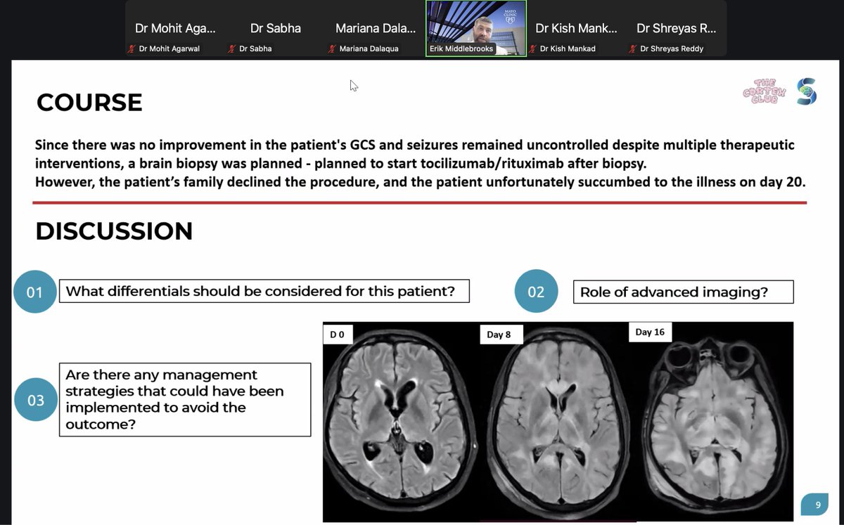 Mohit Agarwal (@mohittccneuro) on Twitter photo In the real world, sometimes we don't have all the answers and we seek help from colleagues. This platform brought these global 'colleagues' together for consult and brainstorming! Thank you to our expert panelists <a href="/EMiddlebrooksMD/">Erik Middlebrooks, MD</a> and <a href="/DalaquaMD/">Mariana Dalaqua | MD, CHM, EDiNR, EDiPNR, EDiHNNR</a> for their amazing insights into In the real world, sometimes we don't have all the answers and we seek help from colleagues. This platform brought these global 'colleagues' together for consult and brainstorming! Thank you to our expert panelists <a href="/EMiddlebrooksMD/">Erik Middlebrooks, MD</a> and <a href="/DalaquaMD/">Mariana Dalaqua | MD, CHM, EDiNR, EDiPNR, EDiHNNR</a> for their amazing insights into