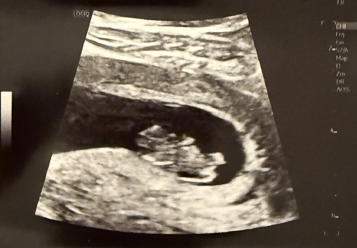 funghibull tweet media