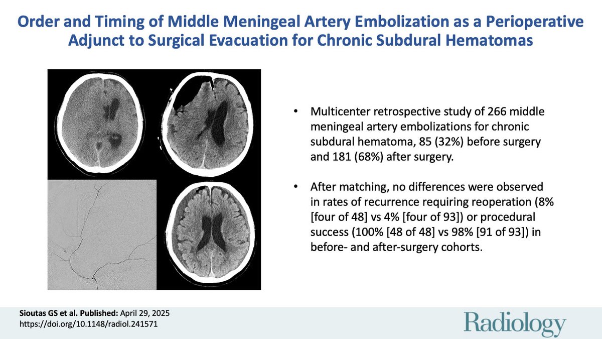 @RadiologyEditor (@radiologyeditor) on Twitter photo When’s the best time for middle meningeal artery embolization in chronic subdural hematoma? ⏰🧠 This study by <a href="/rgrandhi/">Ramesh Grandhi</a>, <a href="/GSSioutas/">Georgios Sioutas, MD</a> and team found no outcome differences based on timing. Useful data for surgical planning! #NeuroRad #Radiology
pubs.rsna.org/doi/10.1148/ra… When’s the best time for middle meningeal artery embolization in chronic subdural hematoma? ⏰🧠 This study by <a href="/rgrandhi/">Ramesh Grandhi</a>, <a href="/GSSioutas/">Georgios Sioutas, MD</a> and team found no outcome differences based on timing. Useful data for surgical planning! #NeuroRad #Radiology
pubs.rsna.org/doi/10.1148/ra…