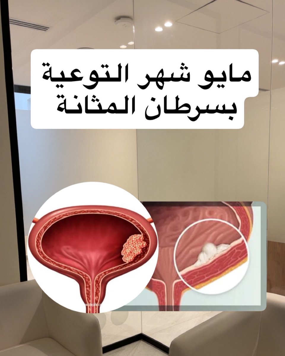 علي العبدالسلام | علاج طبيعي tweet media