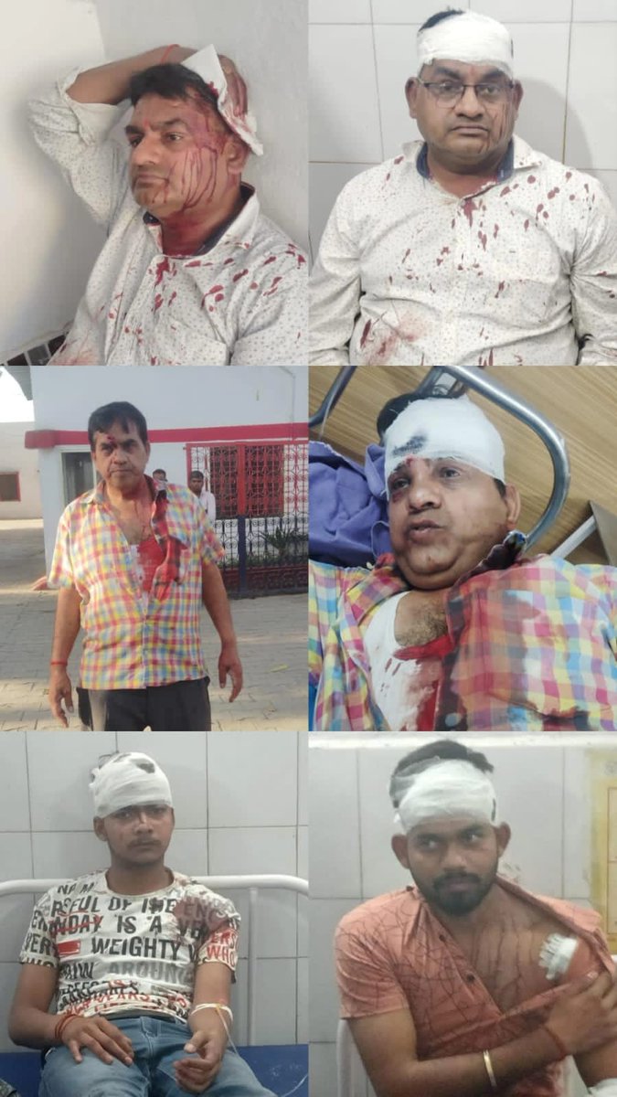 Mr_H_Gupta's tweet photo. @dgpup @JitinPrasada @UPGovt @ANI @aajtak @news24tvchannel @ADGZonPrayagraj @myogiadityanath आज लगभग 9 दिन बाद भी अन्य दबंग फरार ही हैं जिस तरह का जानलेवा हमला किया गया, पूरा समाज डरा है दबंगों से @pilibhitpolice के हाथ अब भी खाली,पीड़ित परिवार कटटर भाजपाई है तब यह हाल  न्याय का https://t.co/dkq4nYUIDj