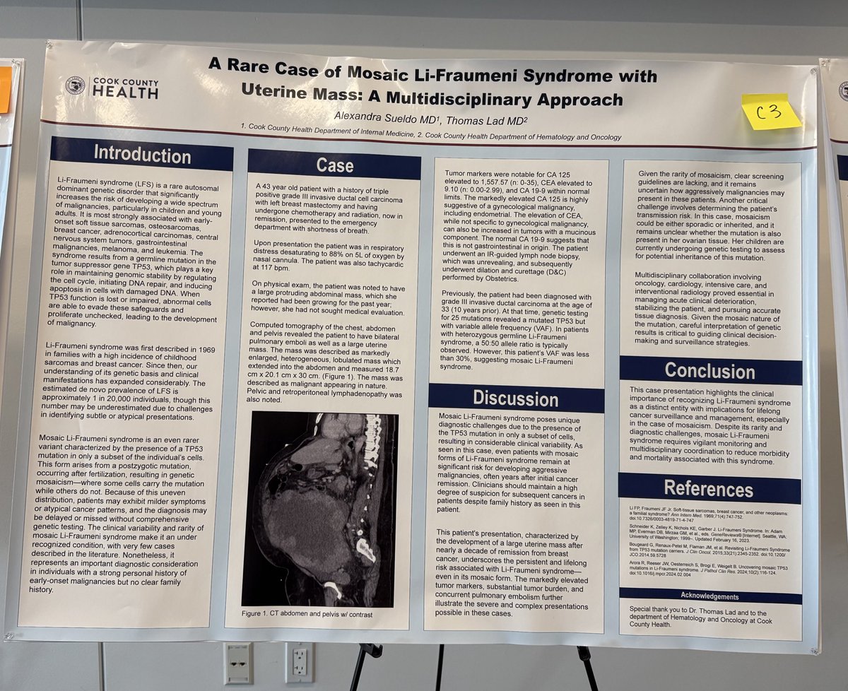 Institutional Research Day here at <a href="/CookCtyHealth/">Cook County Health</a>! Excited to present my case on mosaic Li-Fraumeni syndrome 

#futurehemeoncfellow #hemeonc 🩸