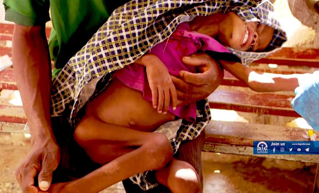 ቅሳነት🌽 (@k_n14t) on Twitter photo #Tigray needs immediate humanitarian access. Starving a population is not peace it’s policy-driven suffering.<a href="/k_n14t/">ቅሳነት🌽</a>
#UpholdPretoriaAgreement #TigrayGenocide <a href="/HuwMerriman/">Huw Merriman</a> <a href="/TomTugendhat/">Tom Tugendhat</a> <a href="/HollyLynch5/">Holly Lynch</a> #Tigray needs immediate humanitarian access. Starving a population is not peace it’s policy-driven suffering.<a href="/k_n14t/">ቅሳነት🌽</a>
#UpholdPretoriaAgreement #TigrayGenocide <a href="/HuwMerriman/">Huw Merriman</a> <a href="/TomTugendhat/">Tom Tugendhat</a> <a href="/HollyLynch5/">Holly Lynch</a>