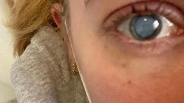 This doctor was facing blindness and eye surgery after 5 years of suffering from a mystery eye infection caught from swimming in the Amazon. As a “last resort”, she was sent for metagenomic sequencing, which identified a rare form of leptospirosis. After 3 weeks of targeted