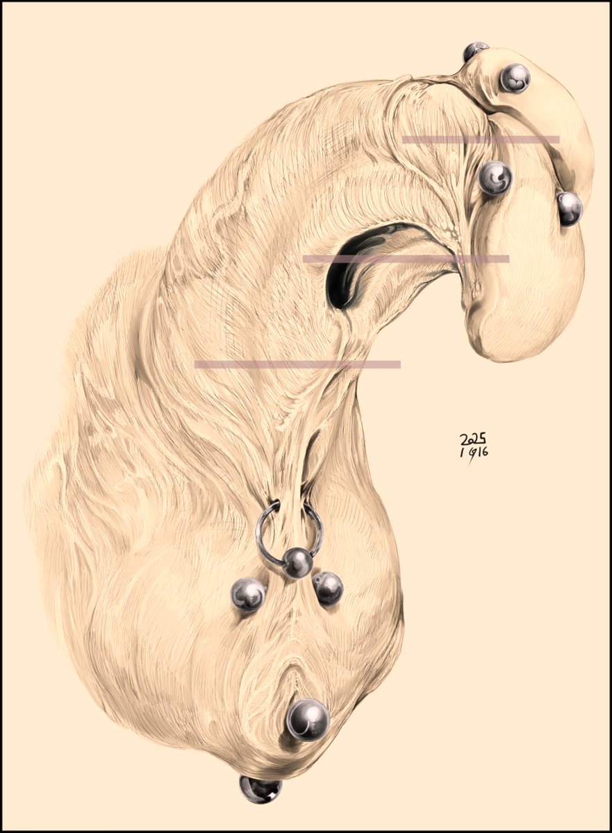 (･･;)genital_bisectionを描いてみました。