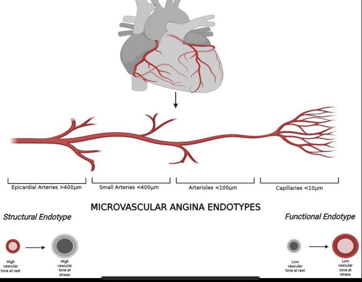 Basalus's tweet image. 1/8
Diltiazem for ANOCA: What’s the real story?
Let’s break down the EDIT-CMD trial and what it does (and doesn’t) tell us about treating coronary vasomotor dysfunction with diltiazem.
#CardioTwitter #ANOCA #CMD
