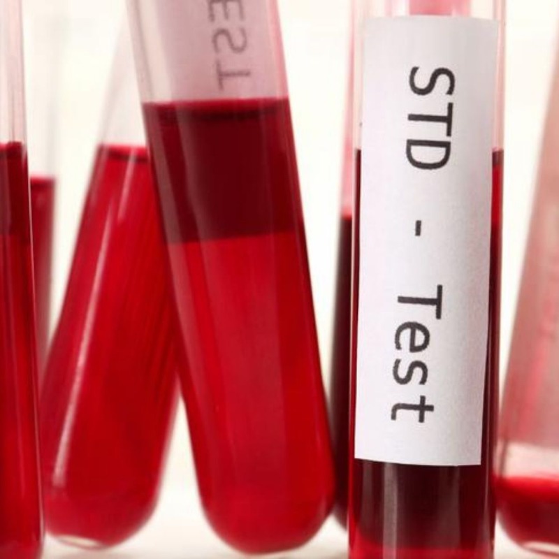 theheraldsun's tweet photo. Australia is grappling with a hidden epidemic of sexually transmitted infections, experts warn. See the interactive map to view the areas with the biggest increases.