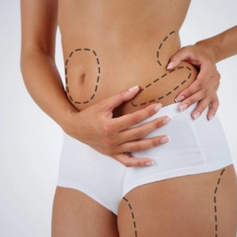 KristenJakobitz's tweet image. Myth ❌: Spot reduction works (targeting fat loss in specific areas). 

Truth ✅: You can't target fat loss. Focus on overall fitness and healthy habits for a holistic change. 

#FitnessMyths #BodyComposition #FatLossTips