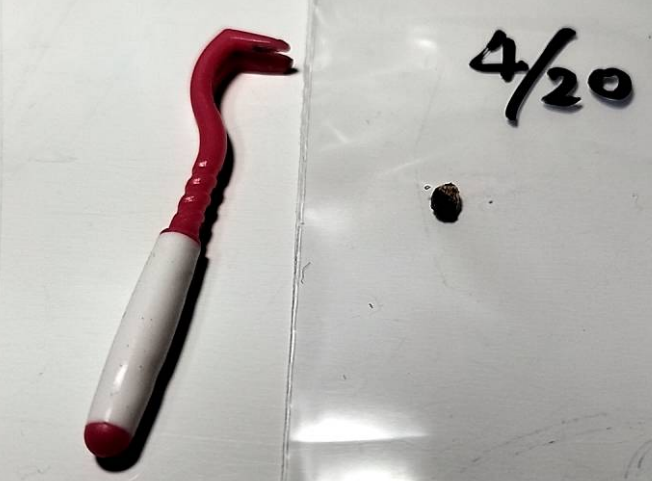 run_super's tweet photo. 初マダニ刺され。。

解体所でお茶いただいた時かな・・・。

結構しっかり喰いついて、リムーバーで引っ張っても離れず。
線香で炙ると良いと聞いたので試したけど全然。
虫よけスプレー＋リムーバーでなんとか取れましが、１０日たってもまだ痛いです。

リムーバー、掴みやすくて便利でした。 https://t.co/GNYOI844Rm