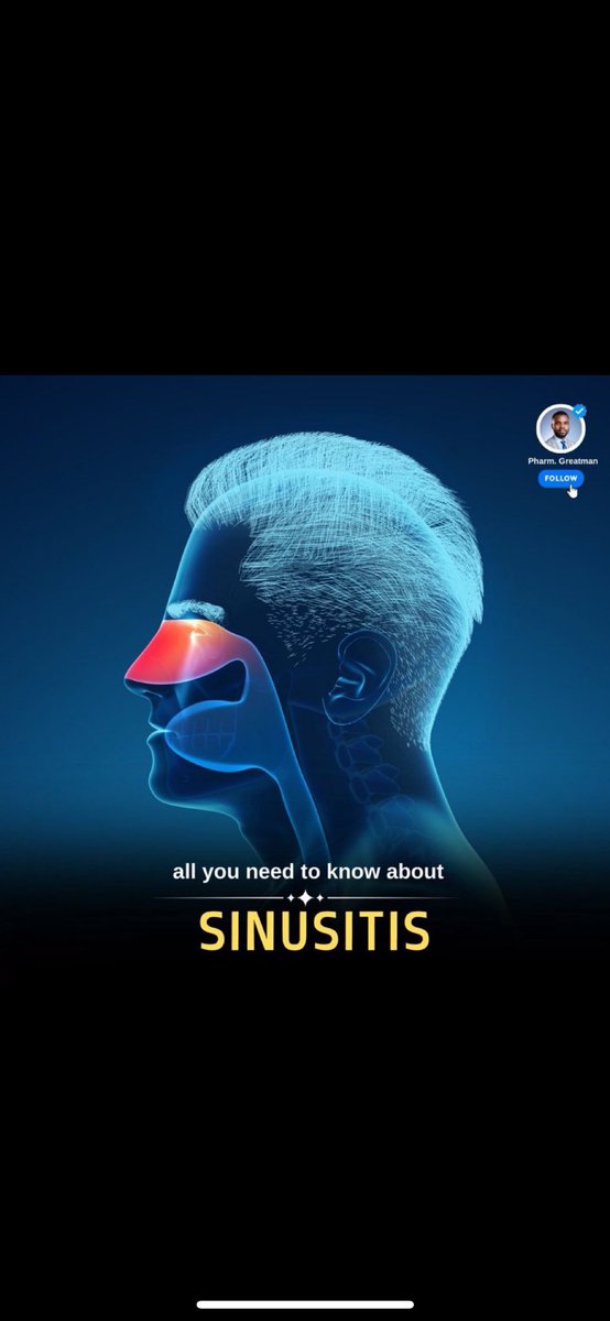 OGreat6's tweet photo. SINUSITIS 101

Sinusitis can cause stuffy nose and pressure in your face

This is the most comprehensive thread you will find on X about Sinusitis what it is, what causes it, and how to keep your sinuses healthy.

A thread https://t.co/Xe0kbgjrln