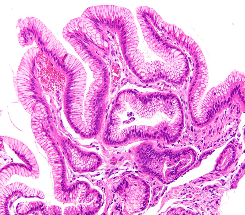 Gunt A.B tweet media