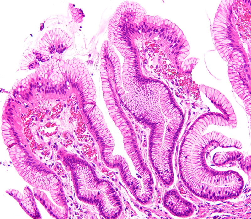 Gunt A.B tweet media