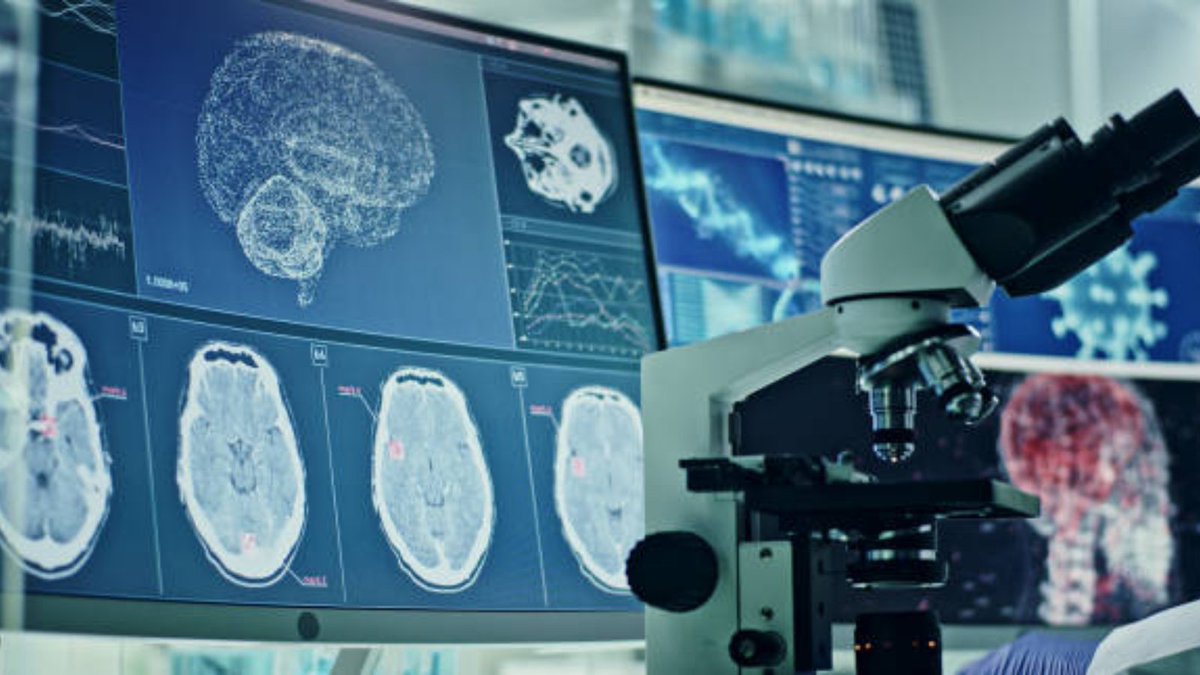 💡New research from FutureNeuro shows that epilepsy surgery may help repair the blood-brain barrier. Recovery of this barrier was seen only in patients who became seizure-free—opening the door to new markers for treatment success: futureneurocentre.ie/publications/r…